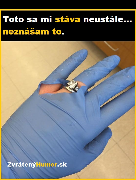 rukavice prsten