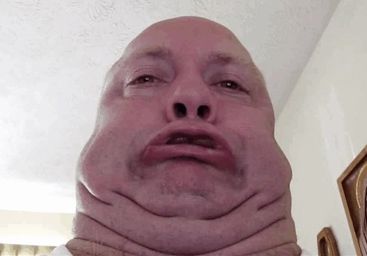 cerv