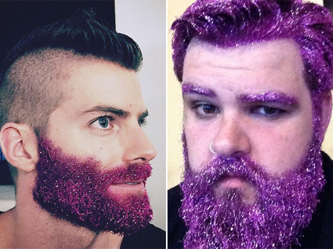 trblietky 4