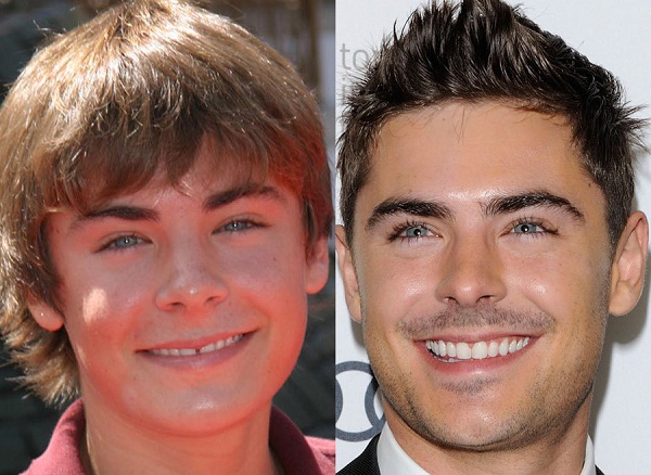 3 zac