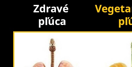 Kto by nechcel