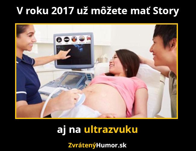 ultrazvuk