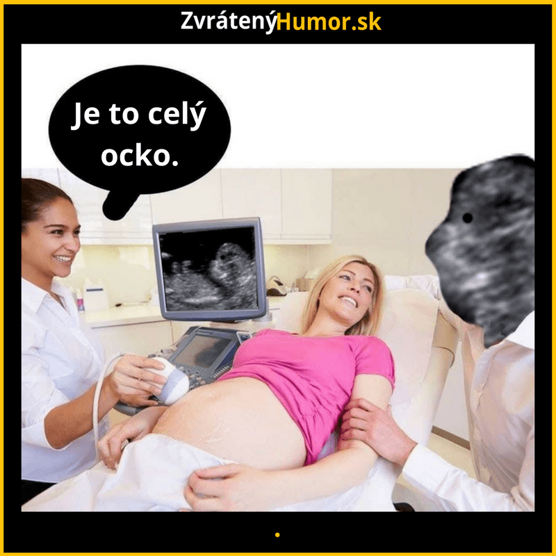 ocko