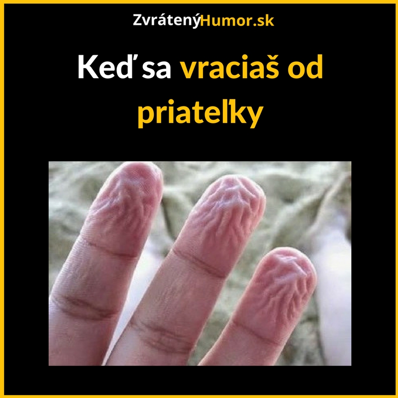 Kvalitný prstoklad