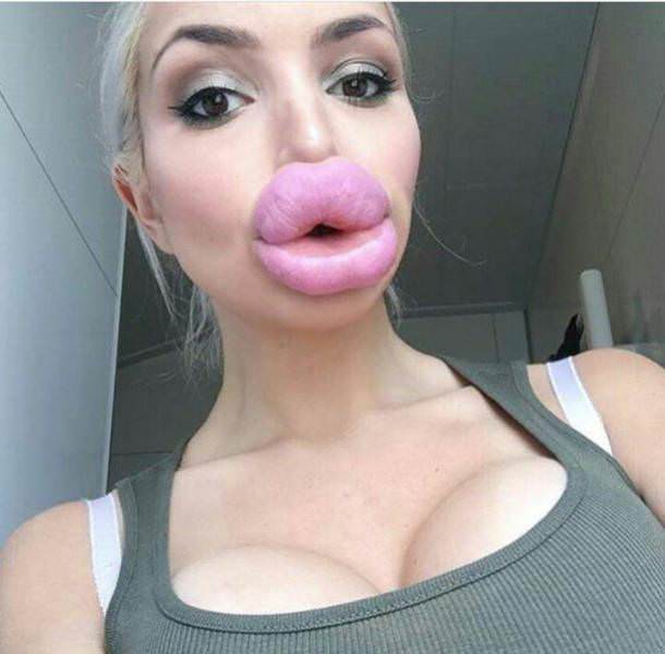 85556506