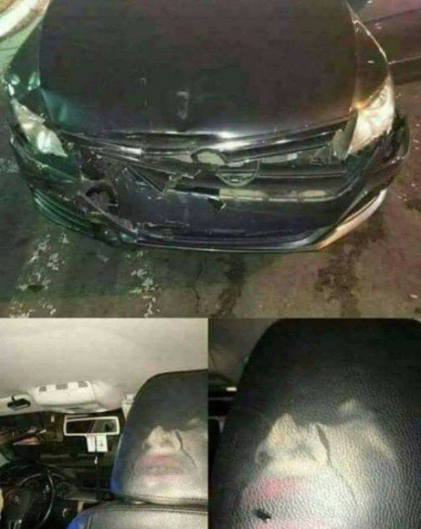 85581174