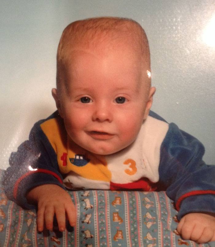 funny-embarrassing-childhood-youth-pictures-10-5ab00a44e8a17__700