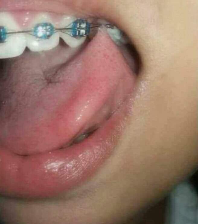 85608695