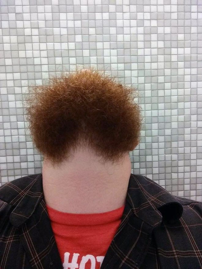 chin1