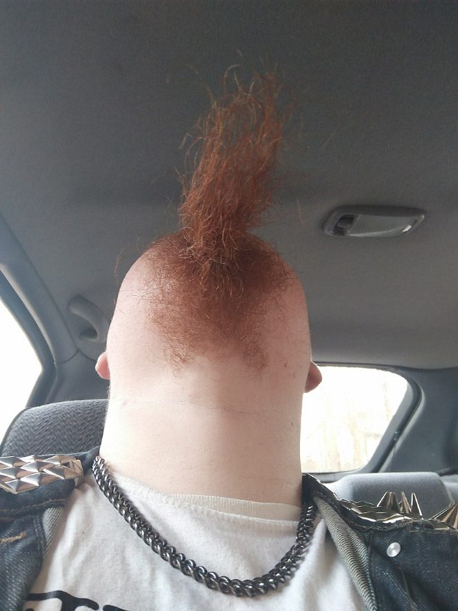 chin3
