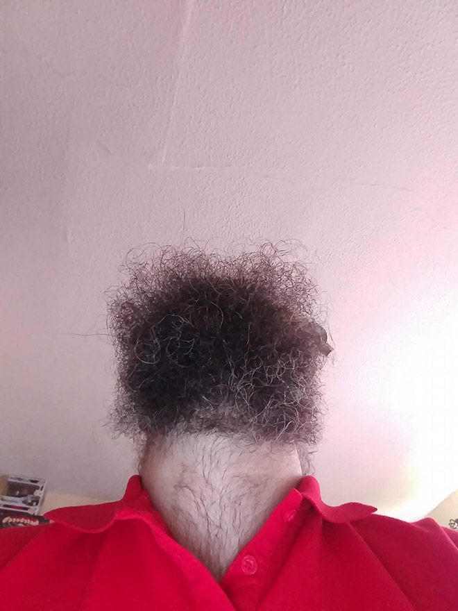 chin7