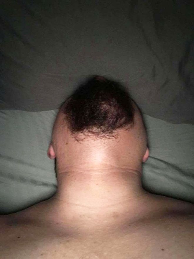 chin8
