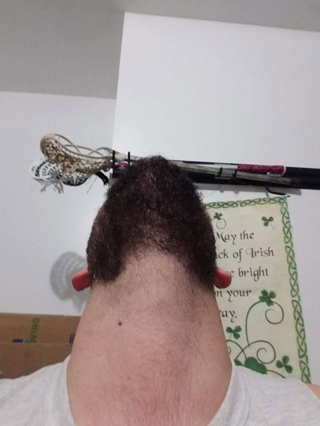 chin9