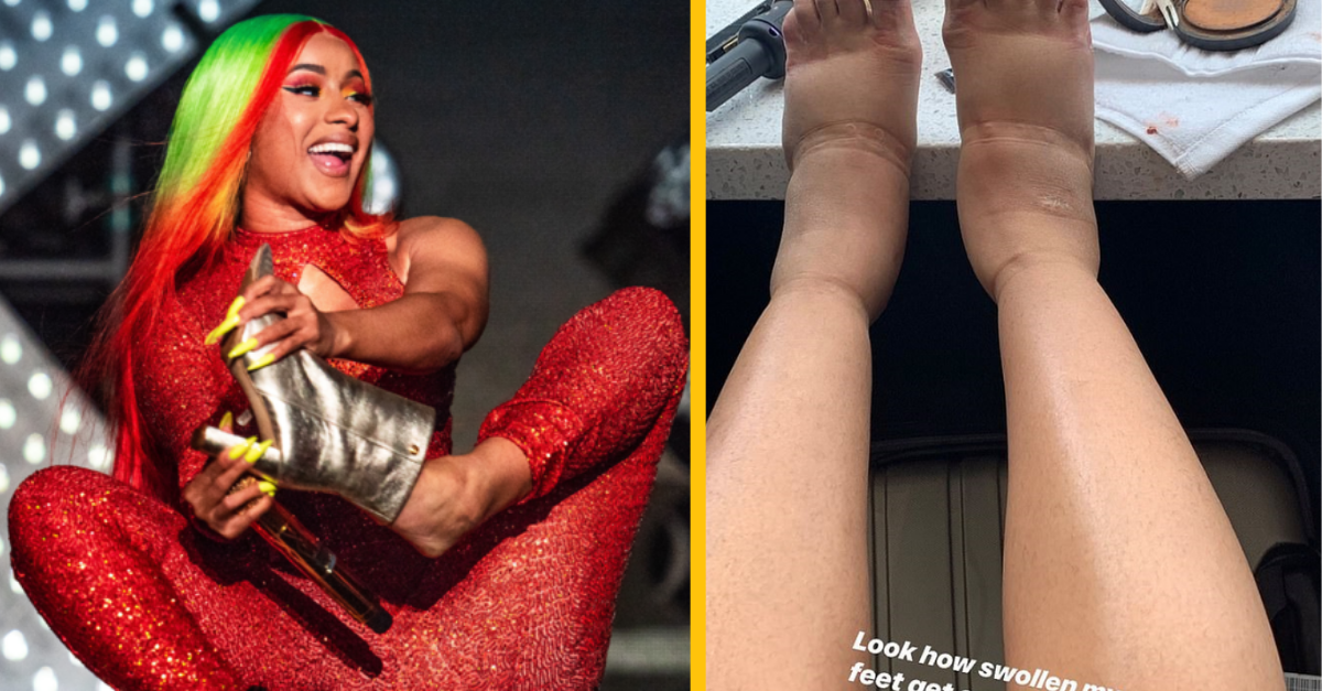 Rapperka Cardi B ukázala svetu svoje opuchnuté nohy a zároveň prisahala, že už nikdy nepôjde na plastickú operáciu