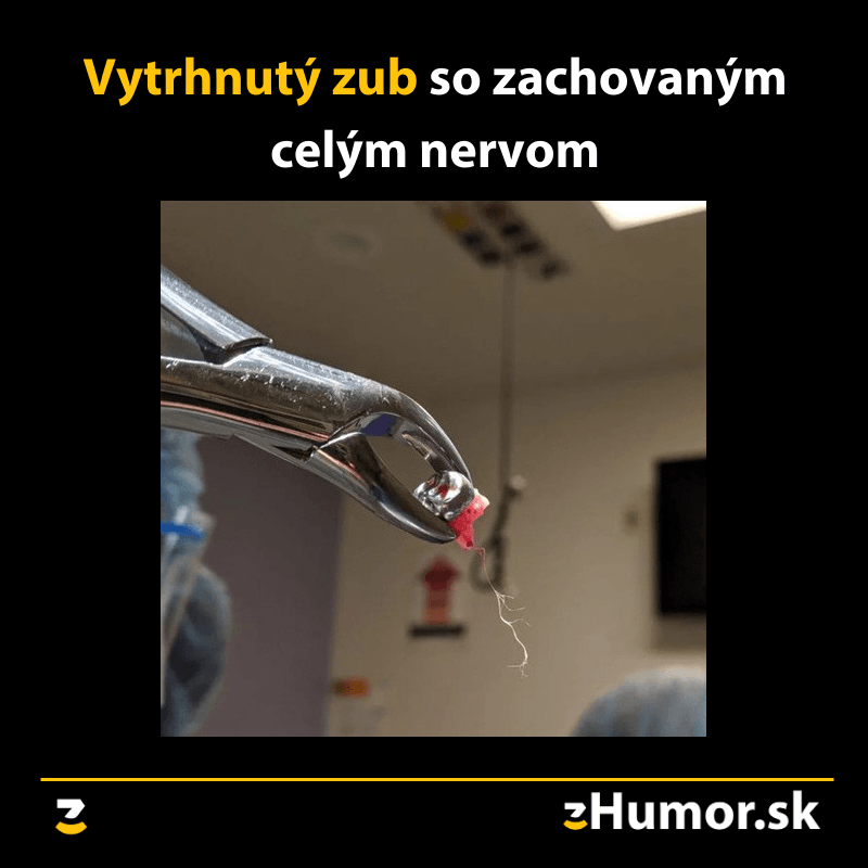 Vytrhnutý zub so zachovaným celým nervom