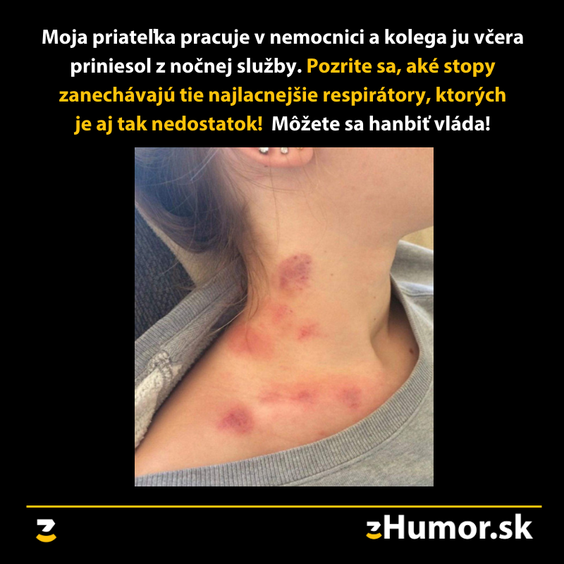 Neuverteľné ako sa šetrí na tých najdôležitejších miestach