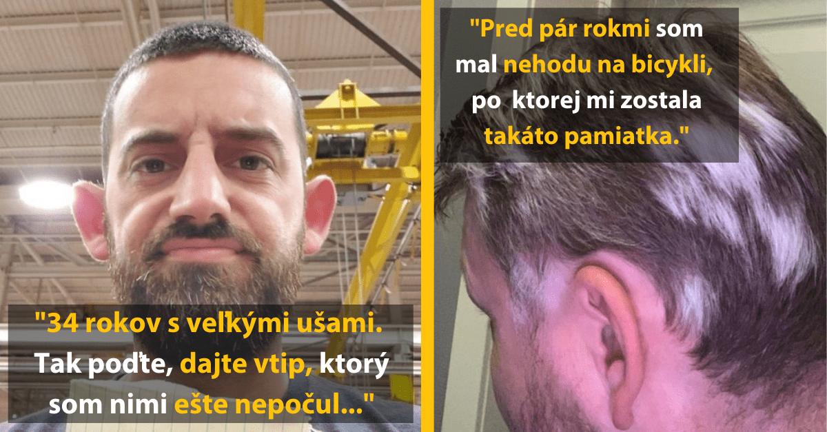 13 jedinečných genetických anomálií, ktoré na ulici uvidíte len veľmi zriedkavo