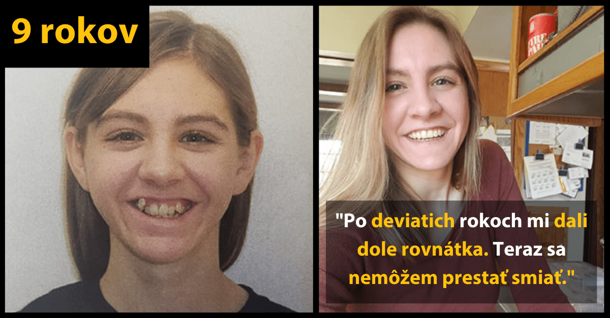 10 prekrásnych ukážok, čo všetko dokáže ČAS