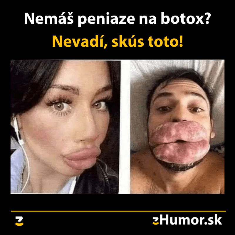 Lacnejší botox