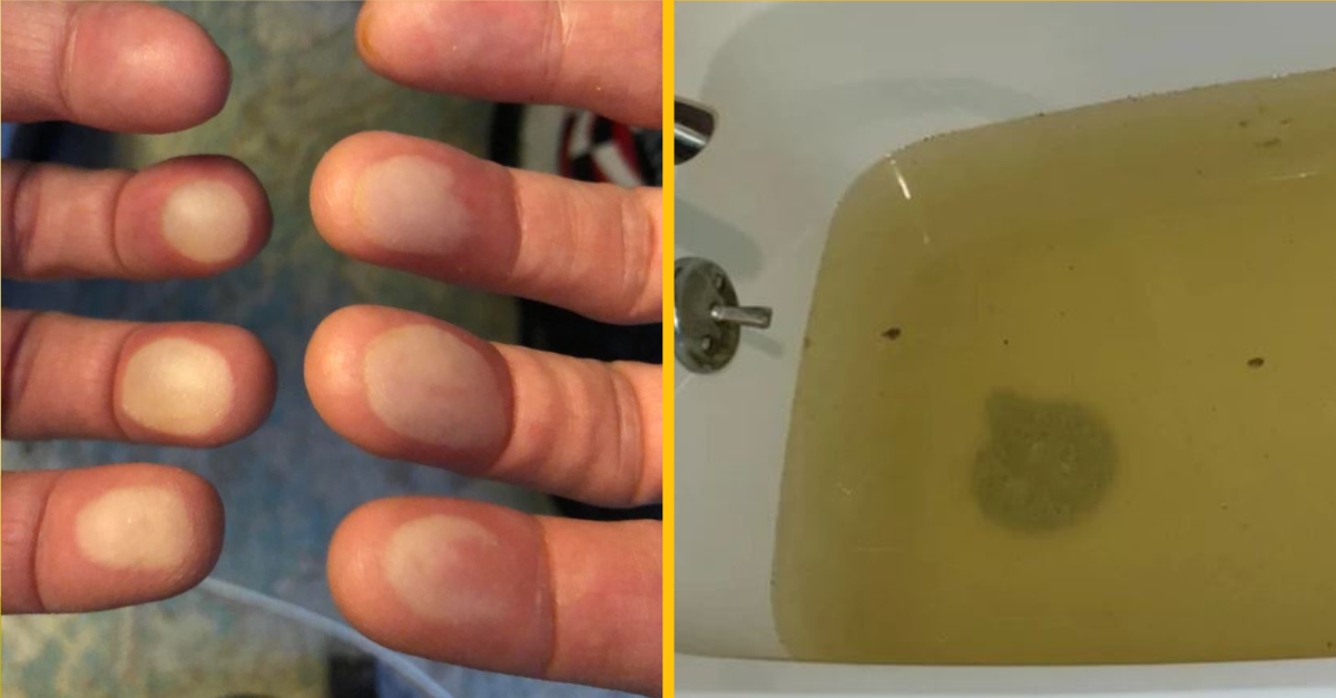 16 ľudí, ktorí sa rozhodli podeliť o svoje zlyhania a sklamania