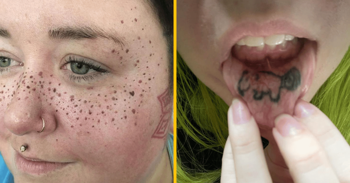 10 katastrofálnych tetovaní, ktoré ťa prinútia pochybovať o ľudskej inteligencii