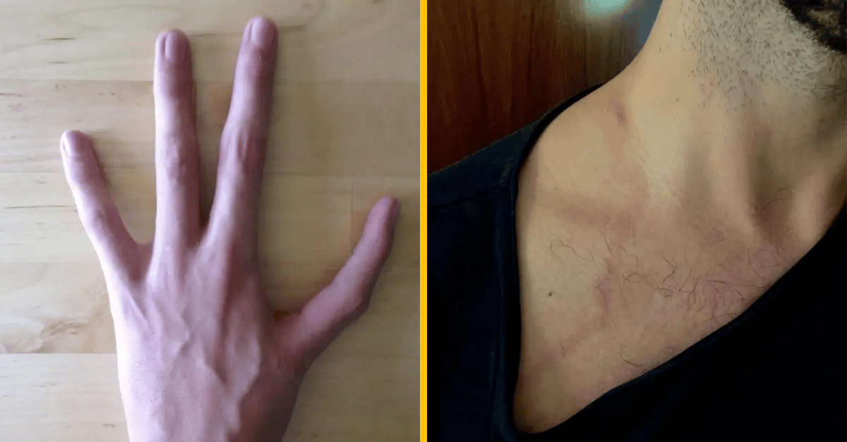 10 abnormalít ľudského tela, ktoré ťa nechajú bez slov