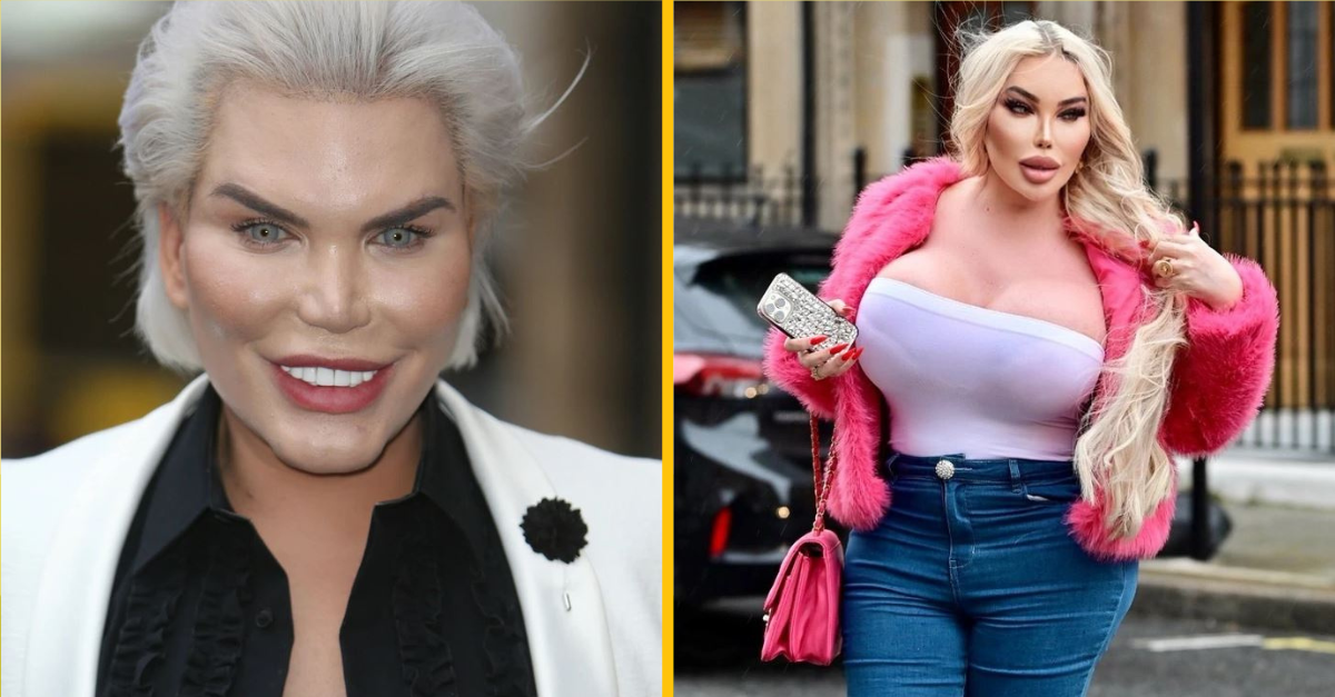 Od ľudského Kena až po bábiku Barbie: Táto trans žena minula viac ako 1 milión dolárov na operácie