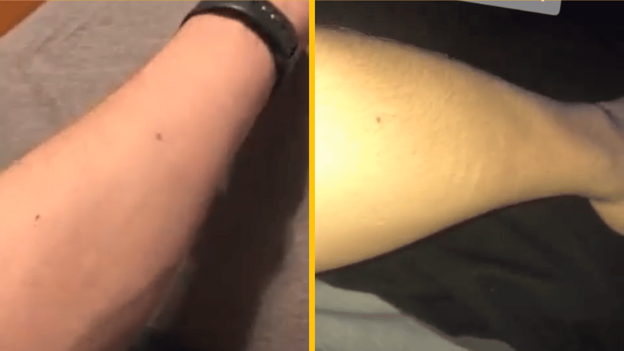 Peha, ktorú majú údajne všetci chlapi! Porovnajte si ruky s ostatnými