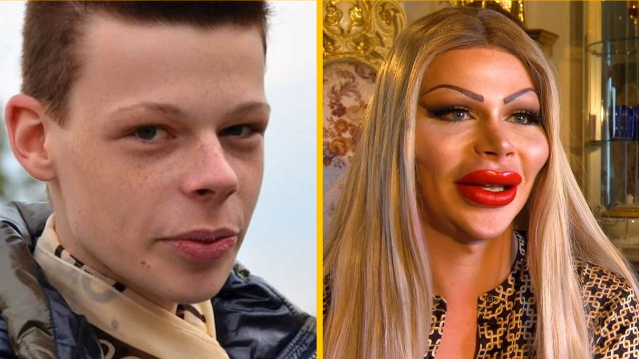 Zoznámte sa s Patrickom Mastom, ktorý minul 73 000 dolárov na to, aby vyzeral ako bábika