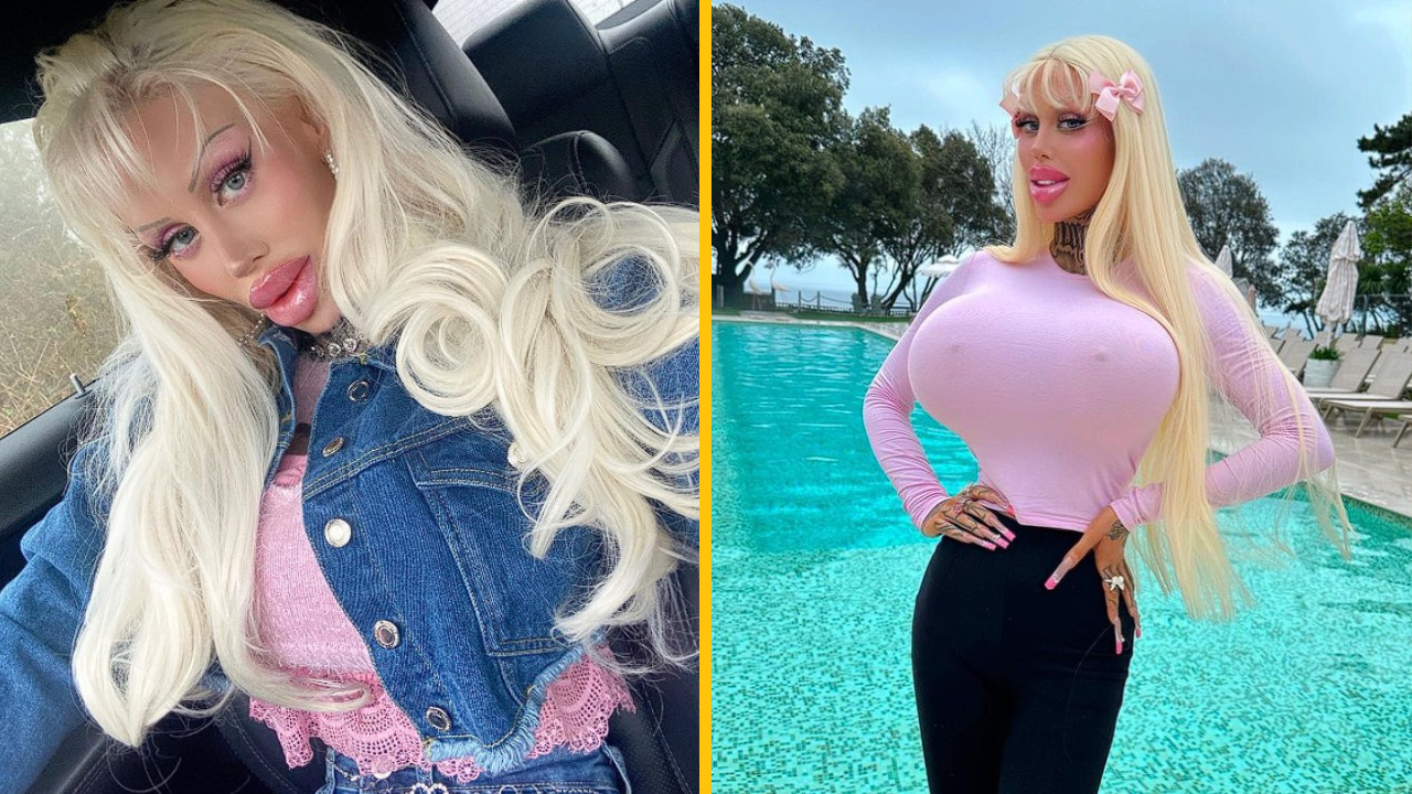 Žena sa rozhodla stať živou bábikou Barbie. Teraz sa snaží inšpirovať aj iné ženy, aby boli viac „plastické“