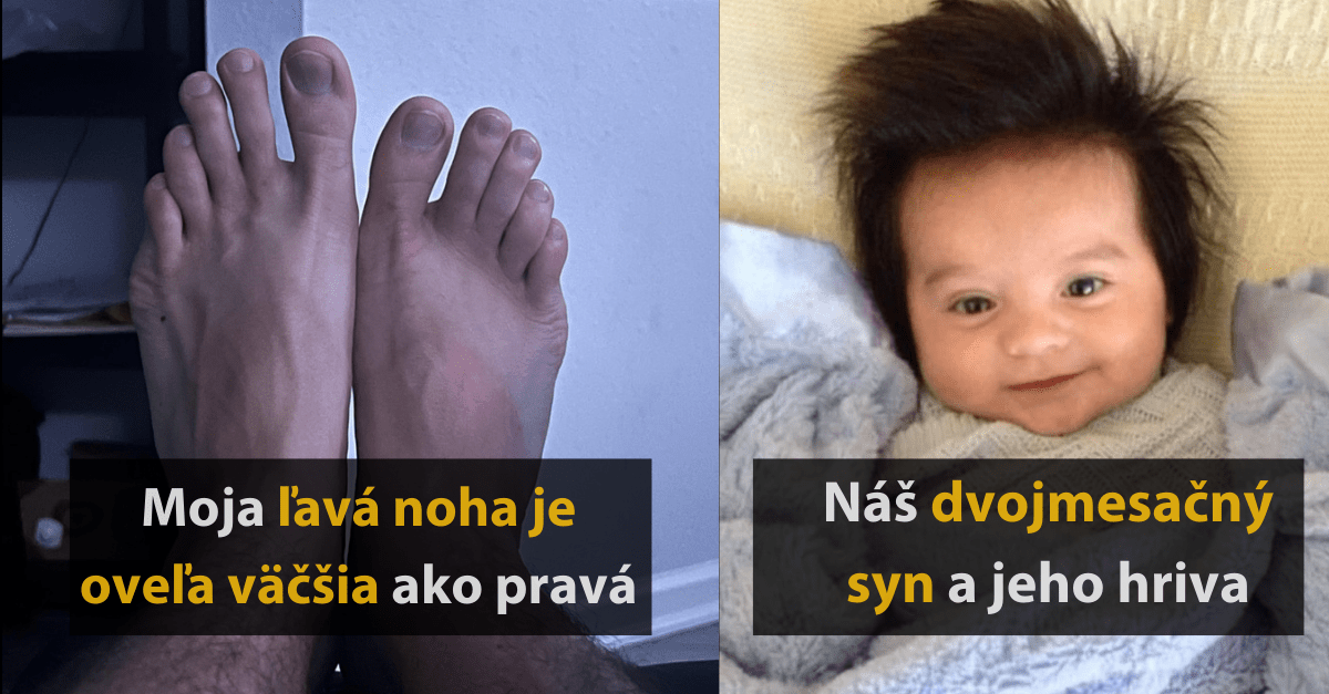 15 komických fotografií ľudí, ktorých by ste v dave určite neprehliadli