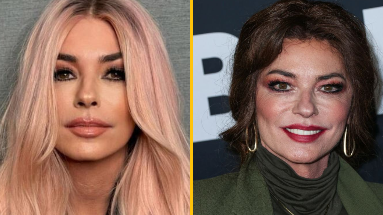 „Zničila si krásnu tvár!“ Shania Twain všetkých šokovala svojím novým vzhľadom