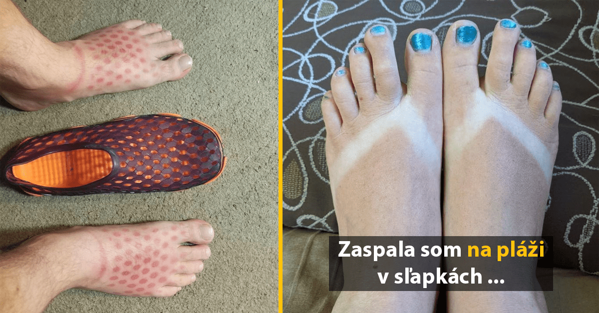 15 zábavných fotografií, ktoré vás pripravia na letné opálenia