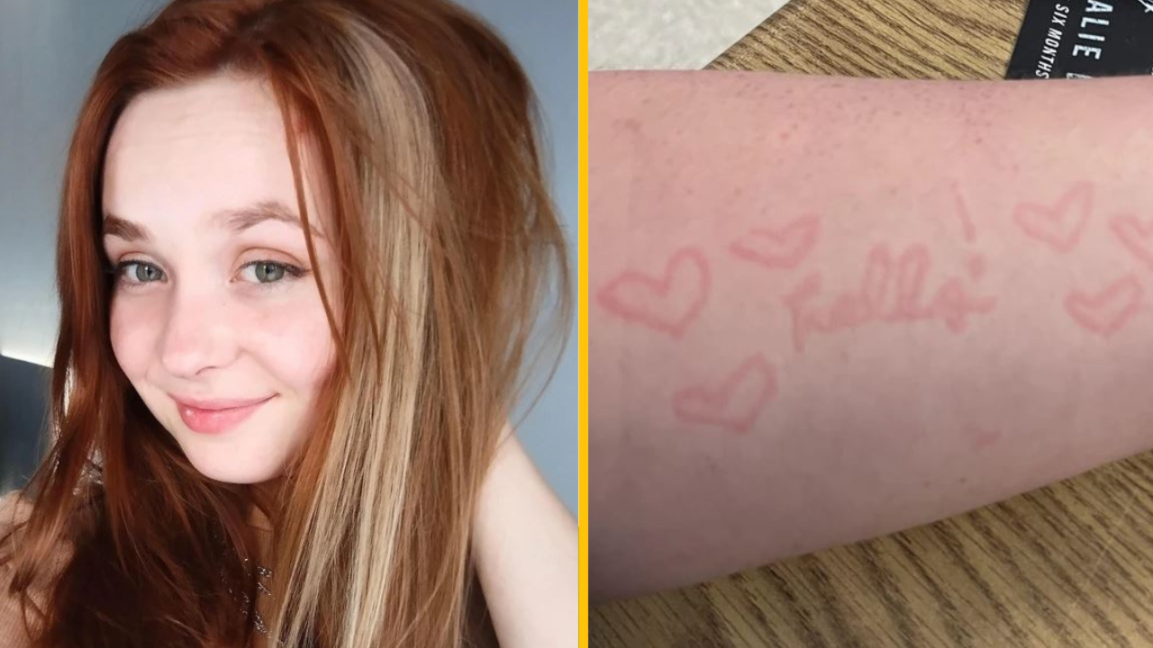 15 ľudí, ktorí ukazujú svoju jedinečnosť naozaj brilantným spôsobom