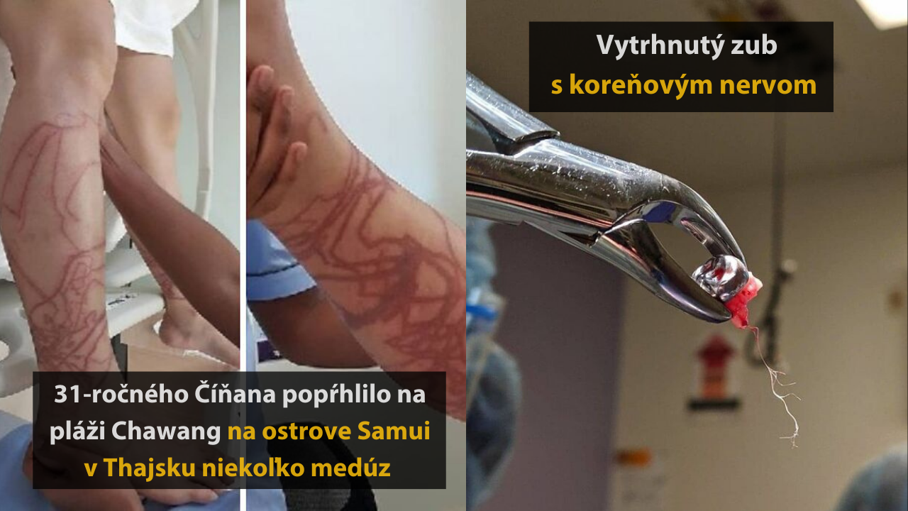 10 medicínskych fotografií, ktoré sú zároveň desivé aj fascinujúce #2