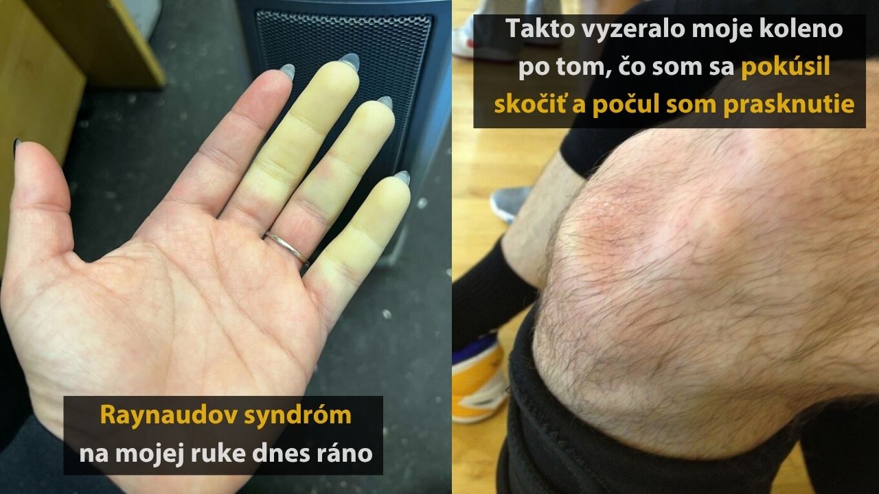 10 fascinujúcich až strašidelných vecí, ktoré sa môžu stať ľudskému telu #2