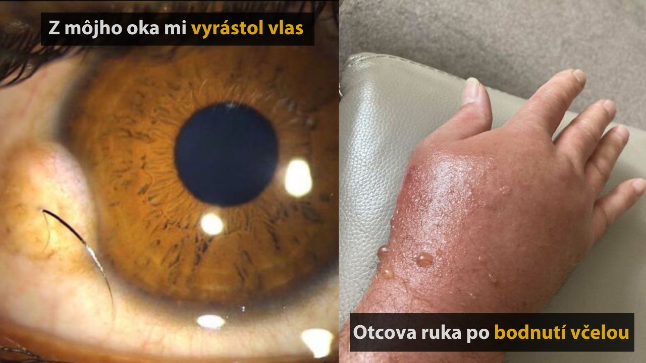 10 fascinujúcich až strašidelných vecí, ktoré sa môžu stať ľudskému telu #3
