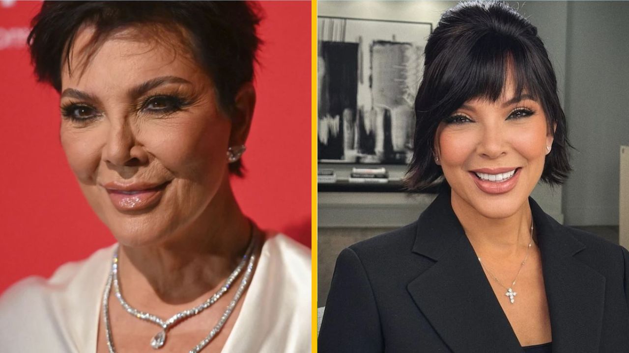 „Najlepší facelift!“ Všetci hovoria o úžasnom chirurgickom zákroku Kris Jenner