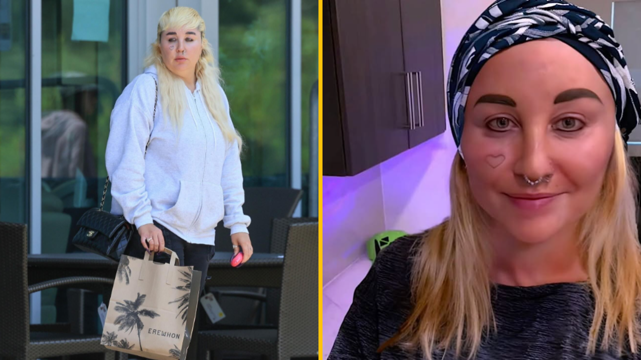 Herečka Amanda Bynes svojim fanúšikom vysvetlila, prečo nemôže nosiť na zuboch drahokamy