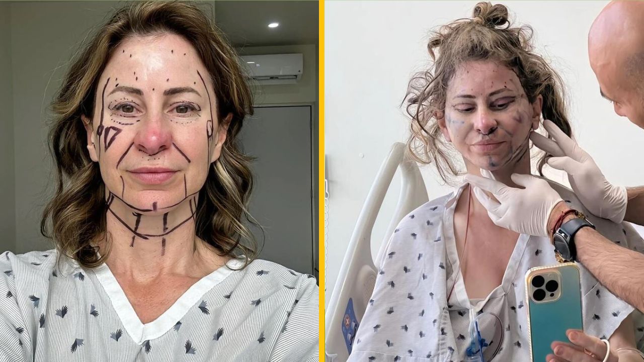 Žena kvôli kráse predala svoj dom, len aby čelila posmechu a ostrým komentárom