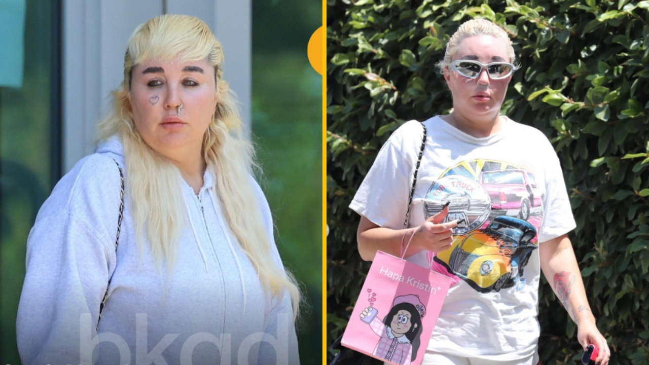 Amanda Bynes podstúpila ďalšiu kozmetickú procedúru. Posúďte sami ako vyzerá