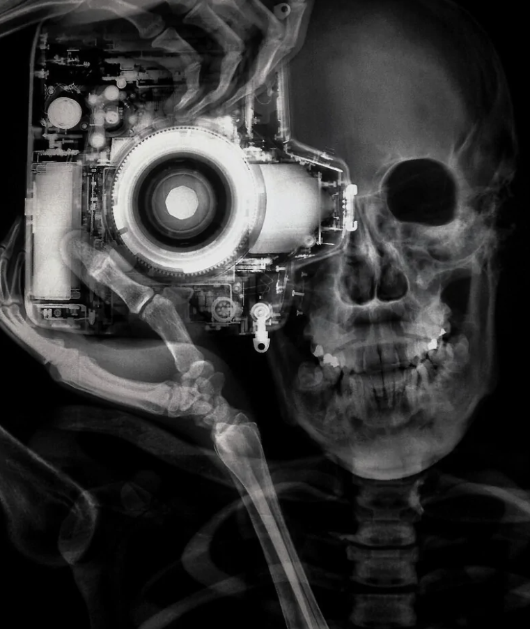 Röntgenový snímka lebky držiacej fotoaparát, zobrazenie kostry a techniky.