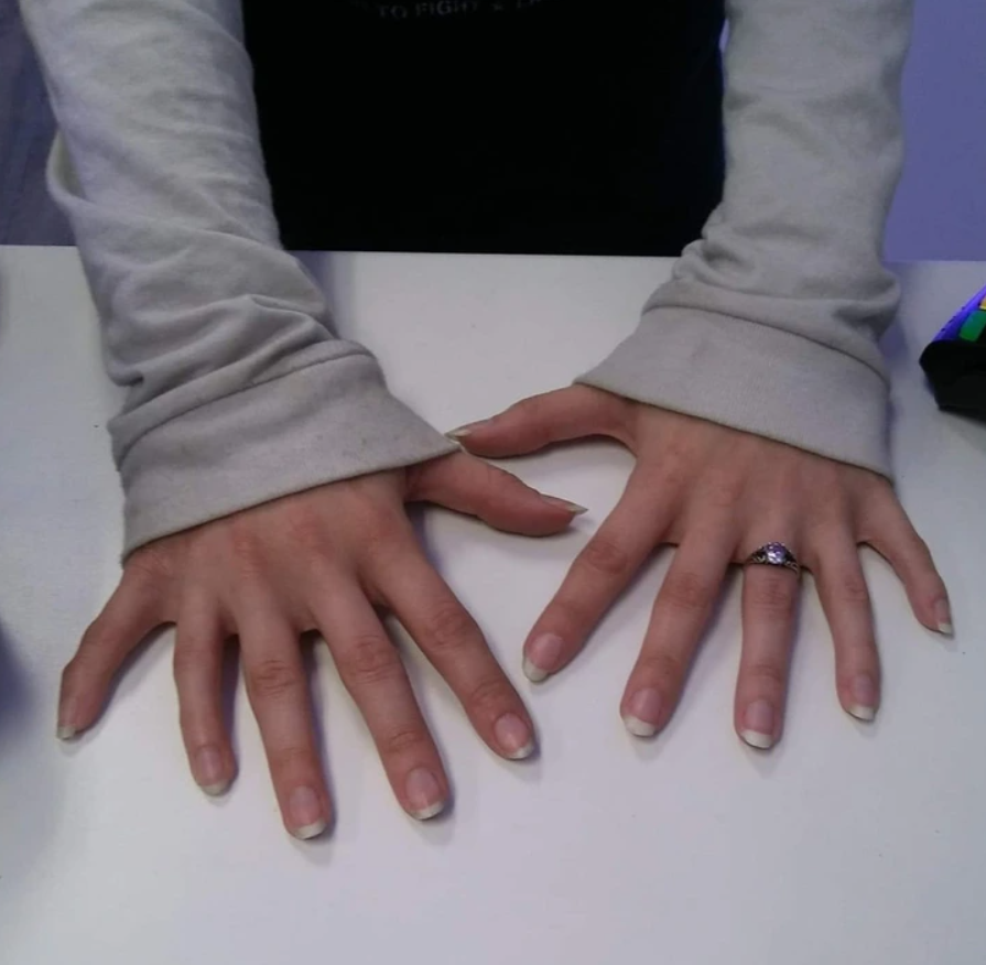 Ruky na bielom stole v sivých rukávoch, zlatý prsteň na prste.