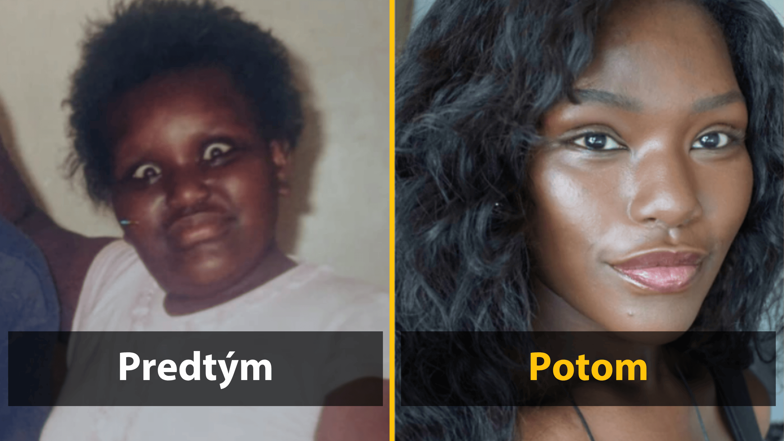 Dvojica fotografií pred a po: výrazná zmena vzhľadu ženy.