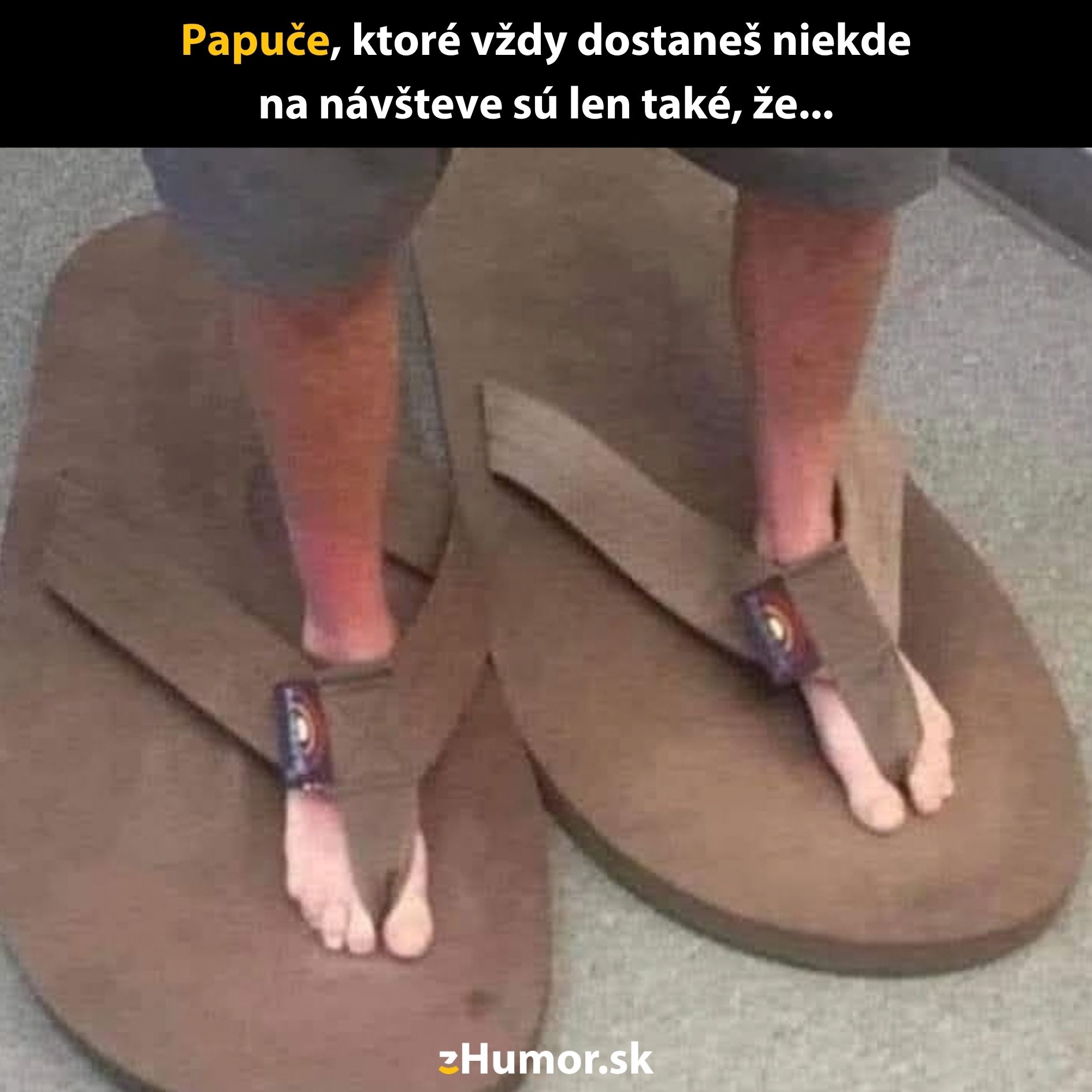 Obrovské papuče vtipne ilustrujú nepraktické a prehnané obutie, ktoré návštevníci často dostanú.
