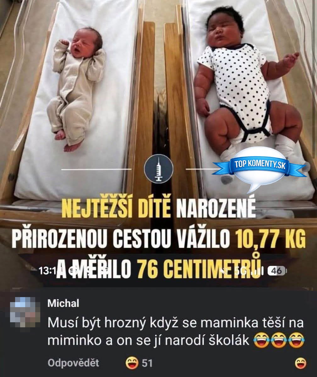 Dve novorodeniatka na vedľa seba postavených postieľkach, jedno výrazne väčšie s popiskom o jeho váhe a dĺžke.